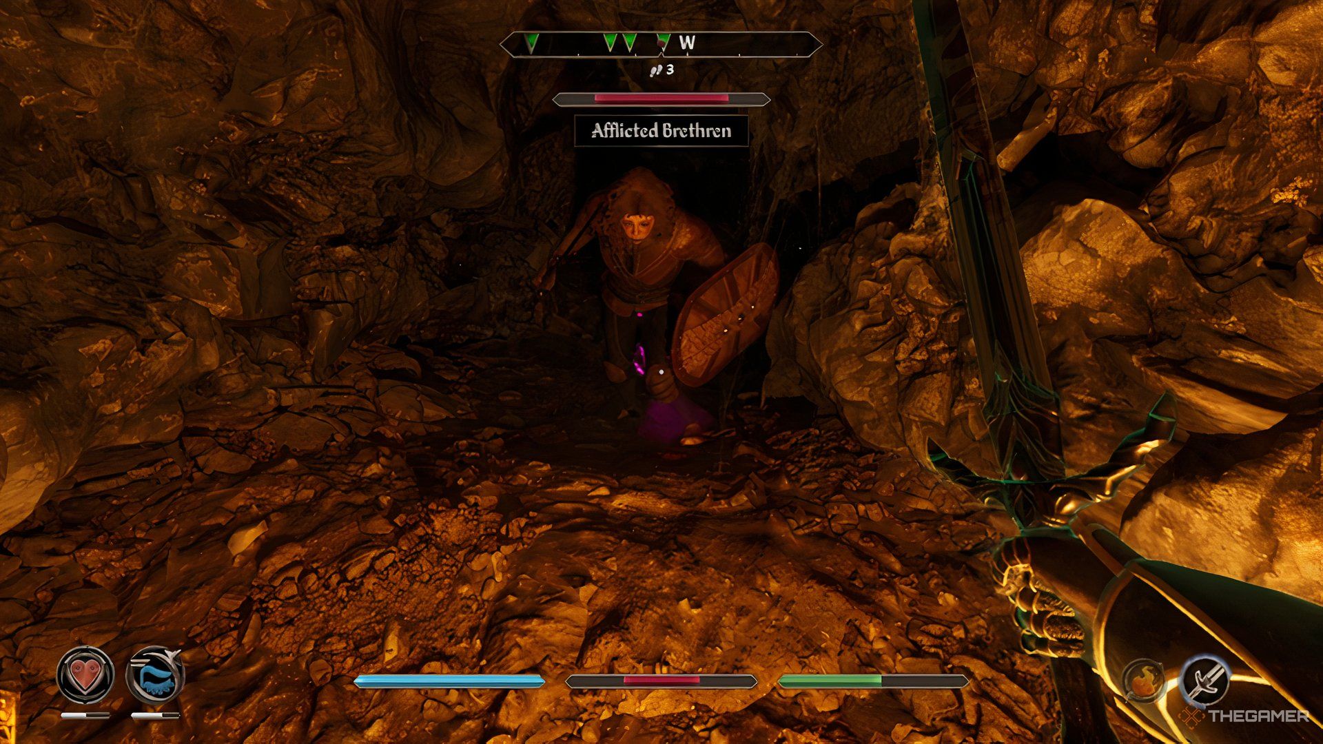 Fighting an afflicted brethren in The Elder Scrolls IV Oblivion Remastered.